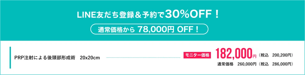 キャンペーン価格