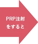 PRP注射をすると