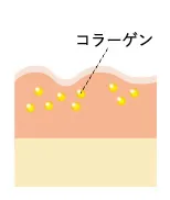 傷ついた皮膚組織が回復する過程で、コラーゲンの生成が促されます。