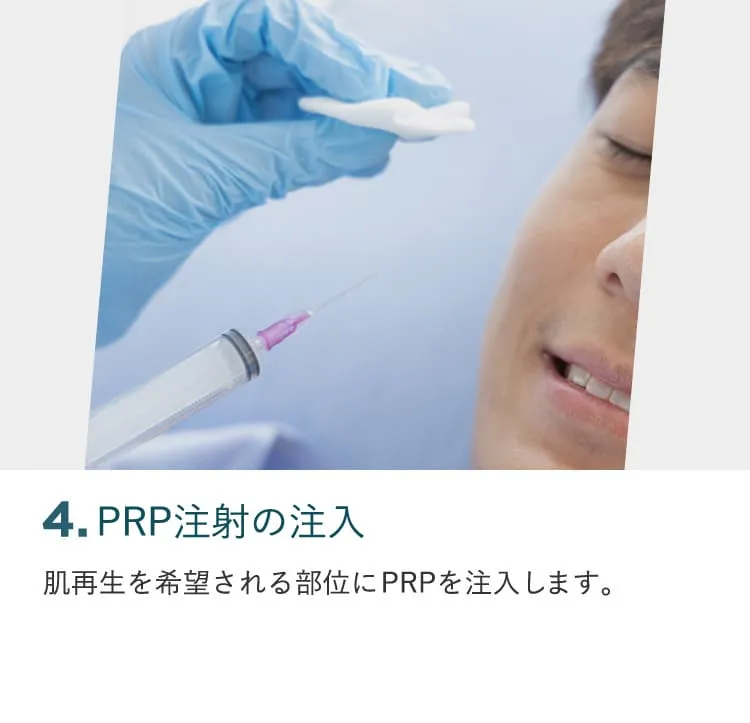 2.PRP注射作製用の採血