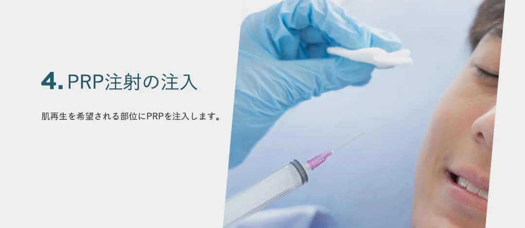 2.PRP注射作製用の採血