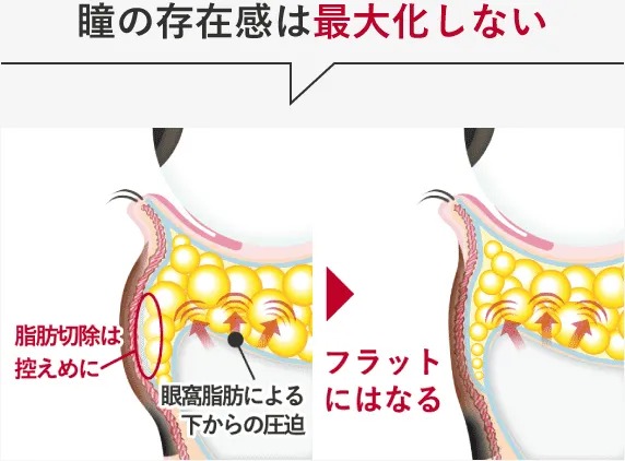 瞳の存在感は最大化しない