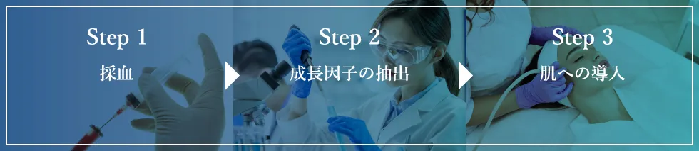 Step1 採血 Step2 成長因子の抽出 Step3 肌への導入